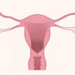 Život s endometriózou: Jak se zbavit ukrutných bolestí?